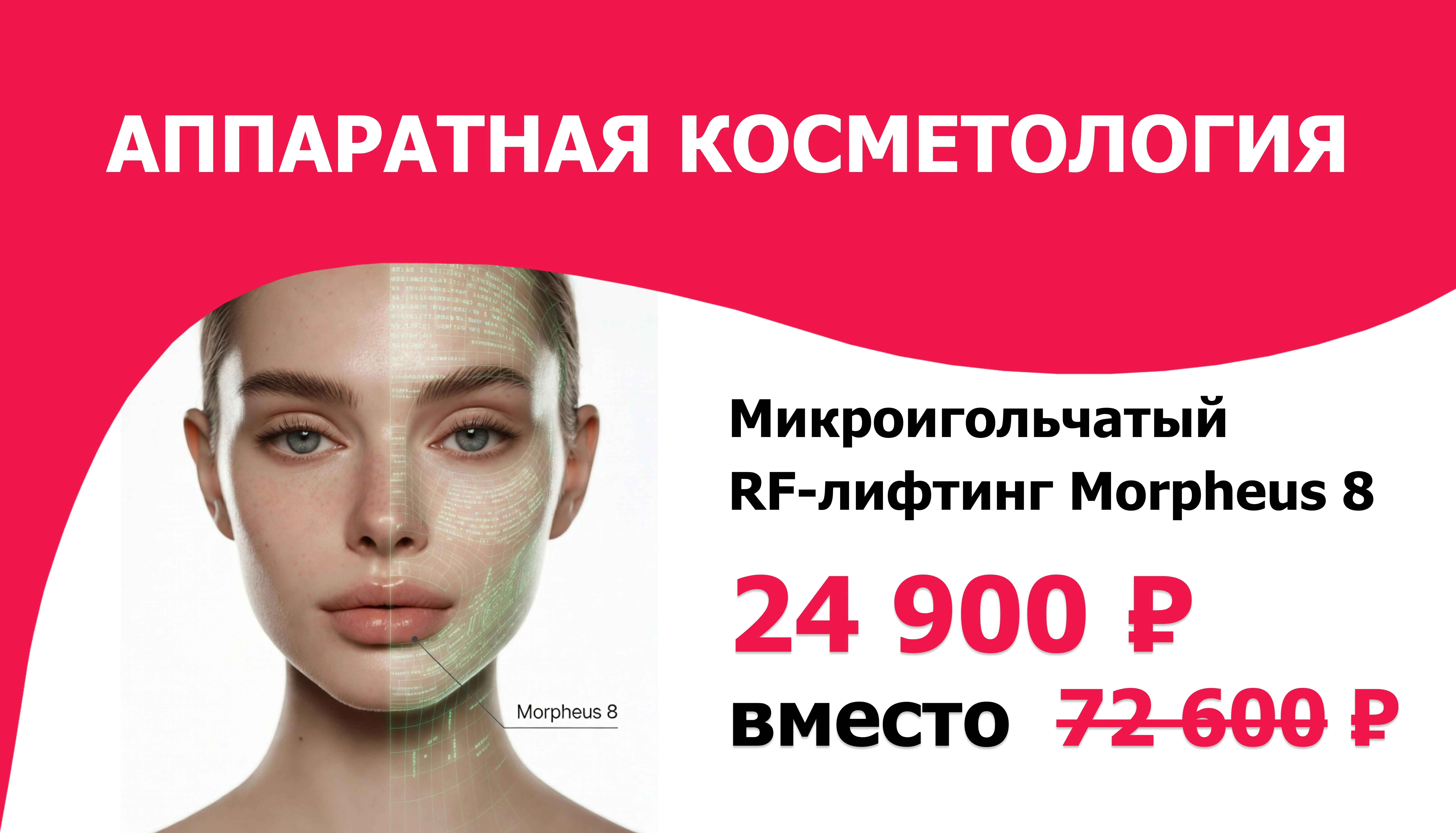 Микроигольчатый RF лифтинг на аппарате Morpheus 8